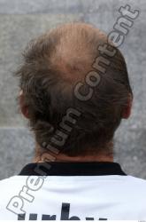 Head Hair Man Woman Casual Average Chubby Street photo references